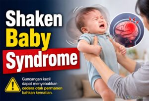 shaken baby syndrome img